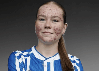 Giudicata per l’acne, zittisce tutti con un goal mozzafiato